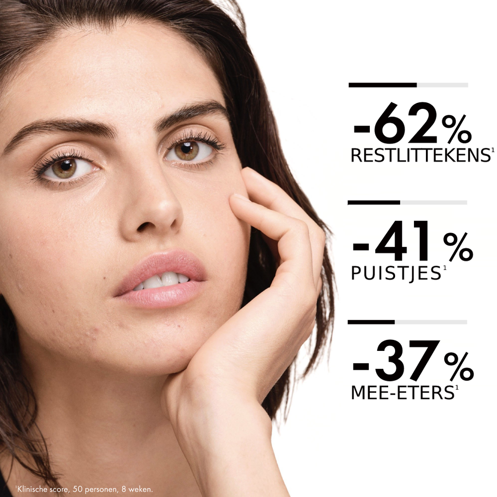 Vichy Normaderm Reinigingslotion + Acne-prone Skin Dagcrème Combi Set (2 stuks) - image 6