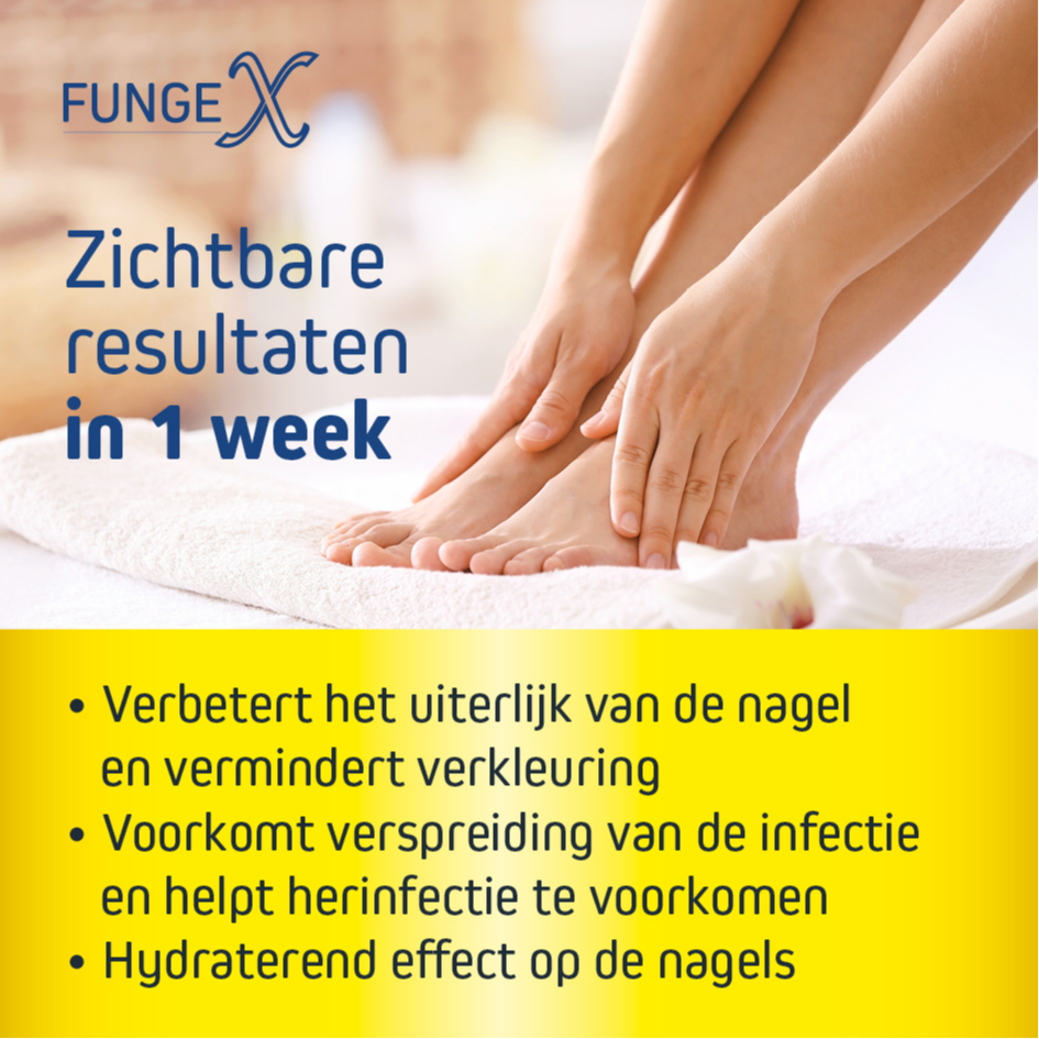 Fungex Kalknagelpleister Forte (14 stuks) - image 4