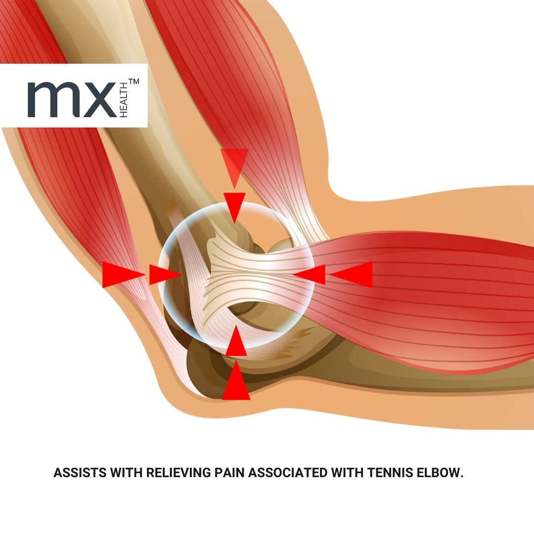 Mx Health Premium Neopreen Tennis Elbow Support - Universal (1 stuk)