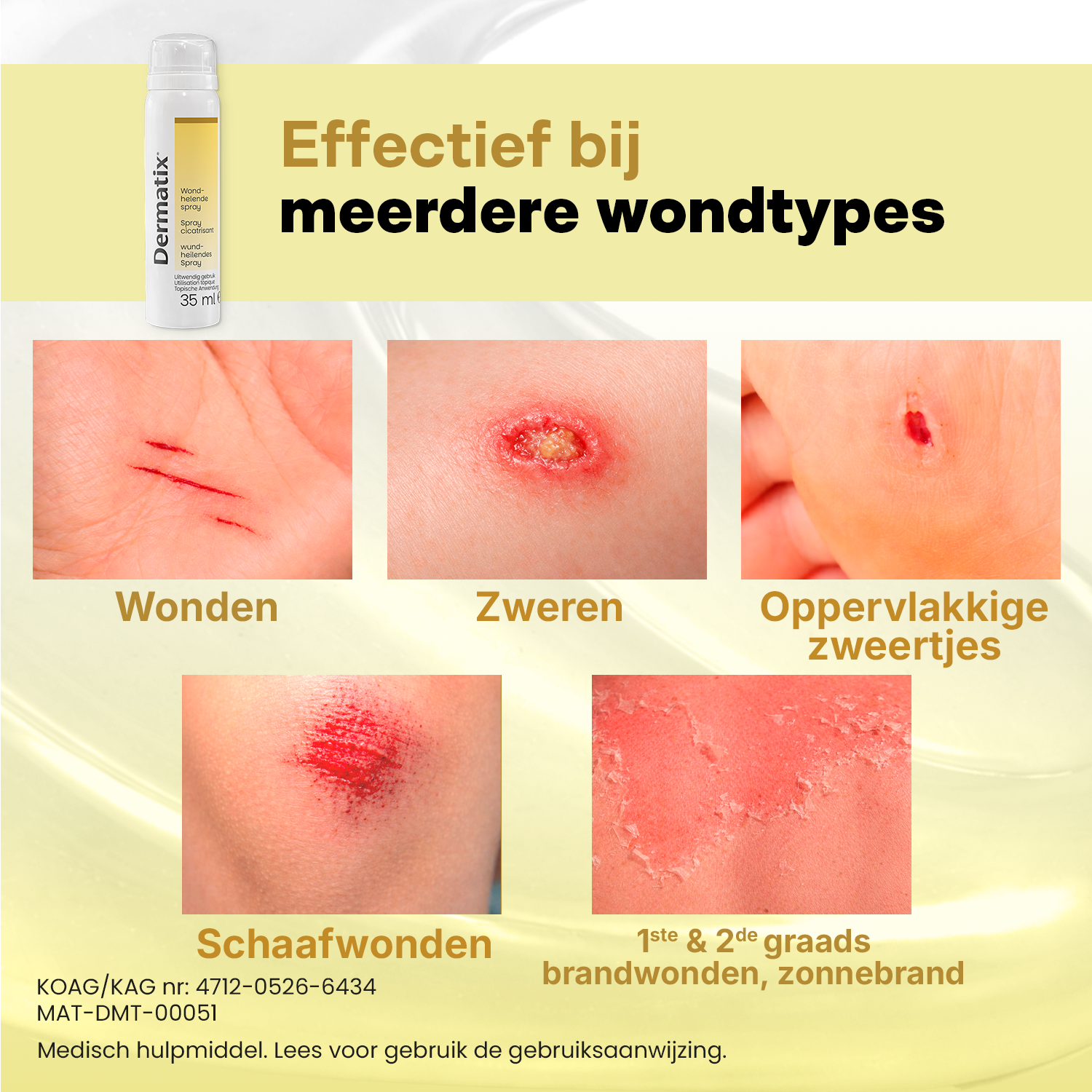 Dermatix Wondhelende Spray (35 ml) - image 4