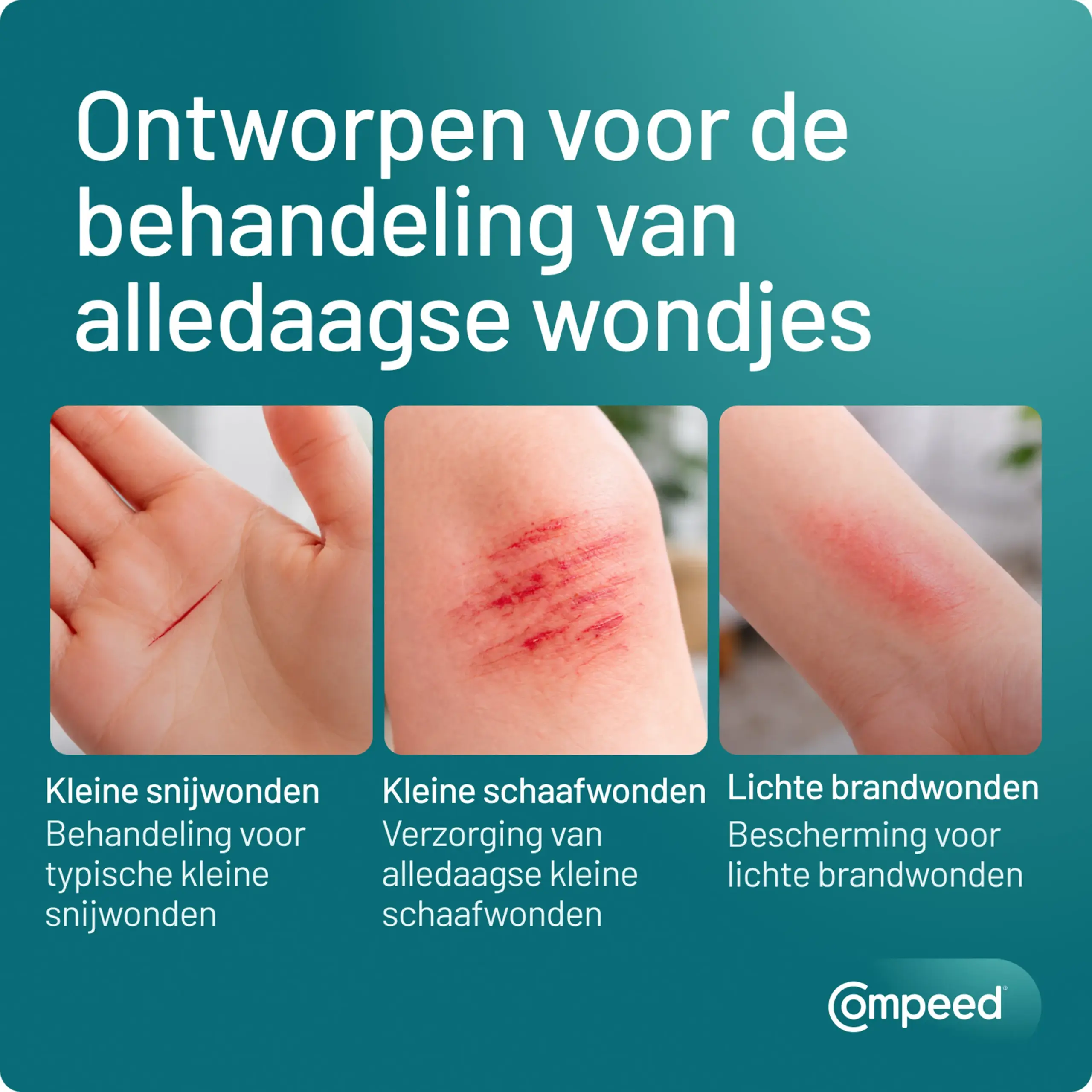 Compeed Smartskin Multi-wond Mixpack (10 stuks) - image 3