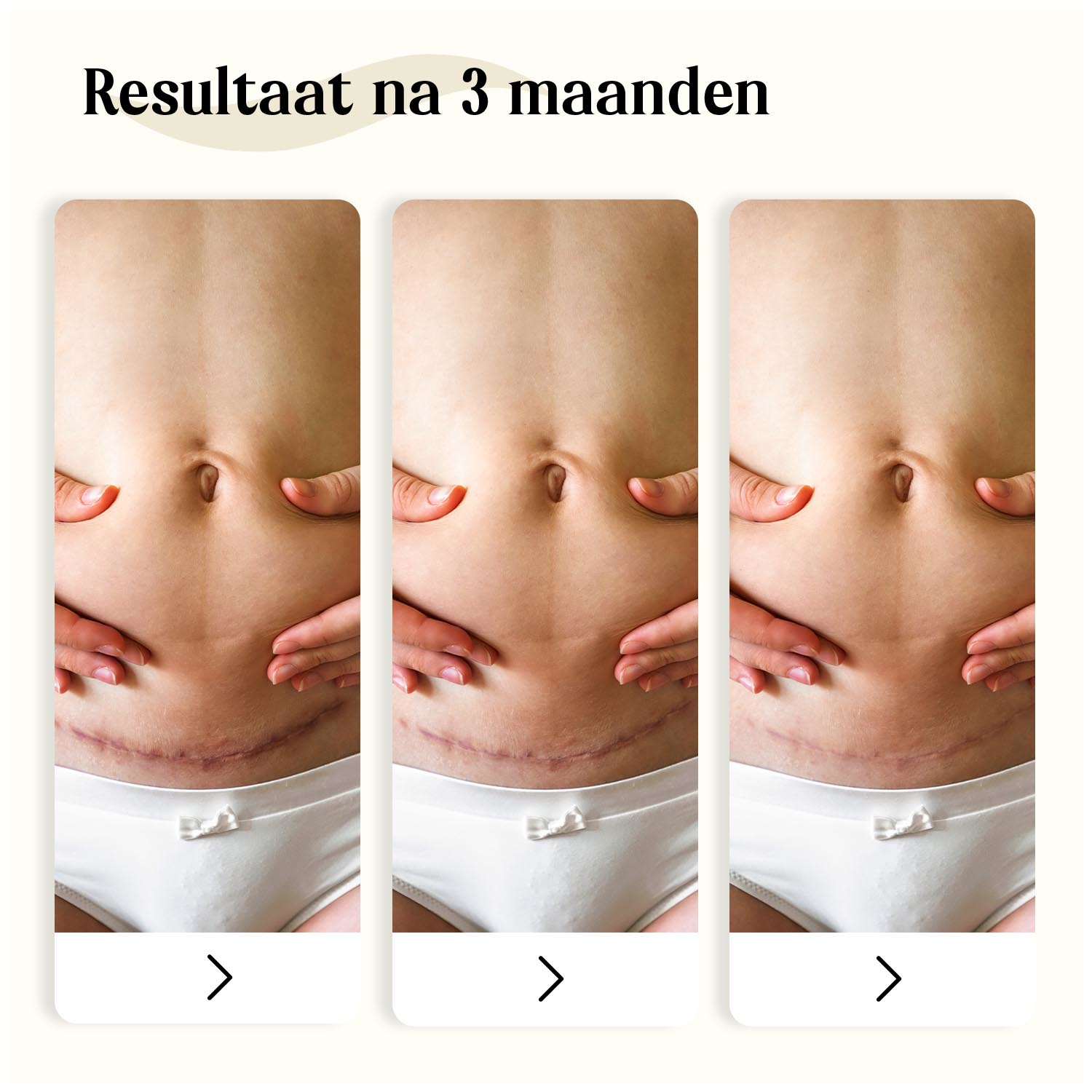 Dermatix Siliconen Gel (15 gr) - image 3