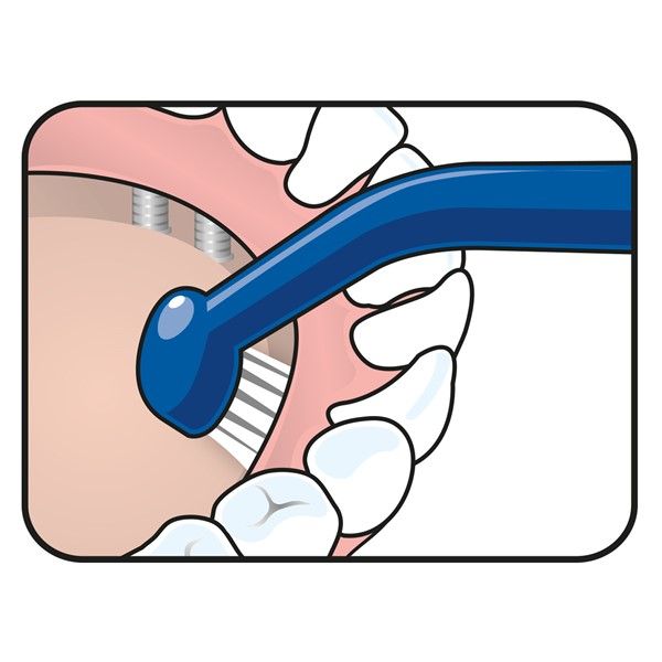 TePe Tandenborstel implant care (1 stuk) - image 4